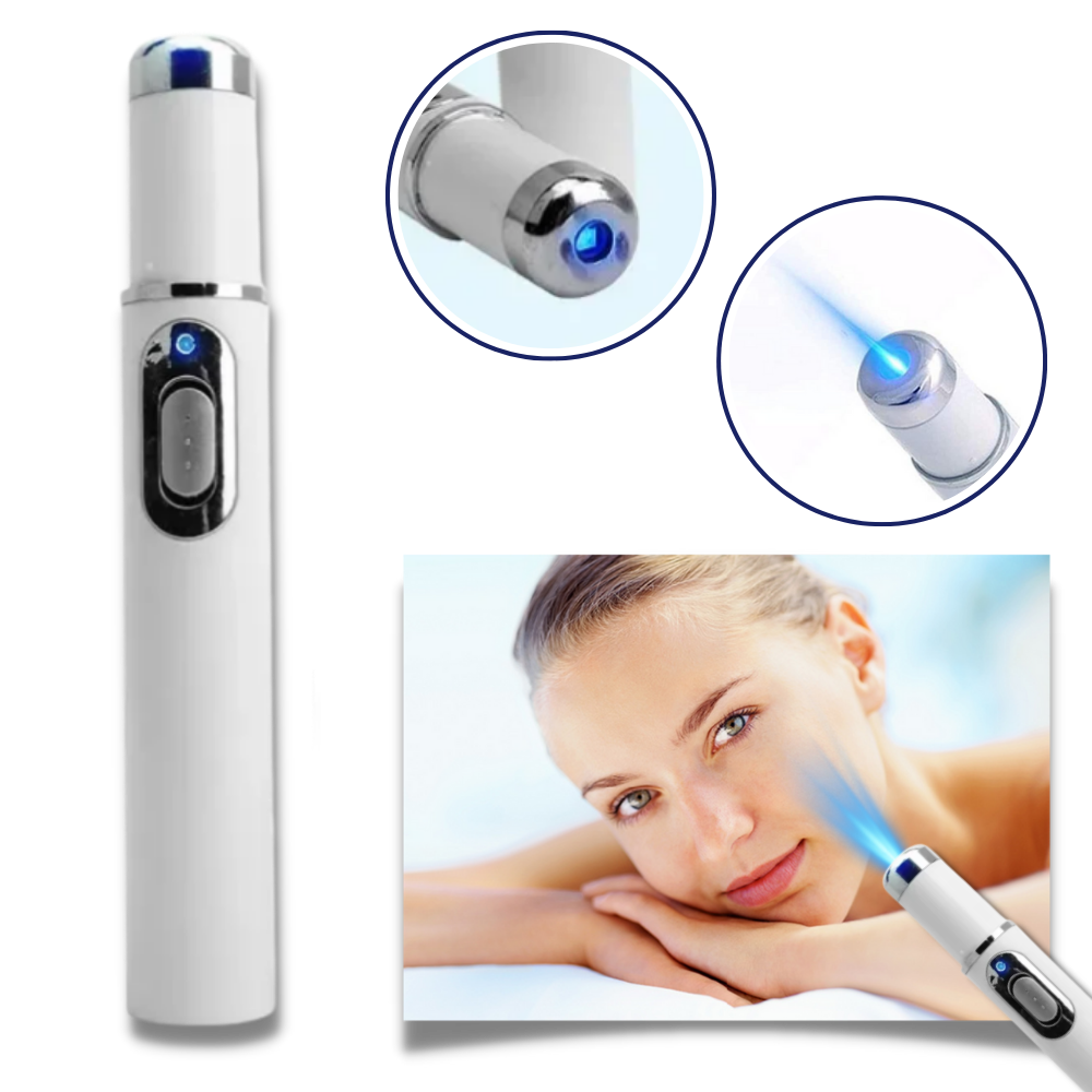 Draagbare Lasertherapie voor een Stralende Teint 2