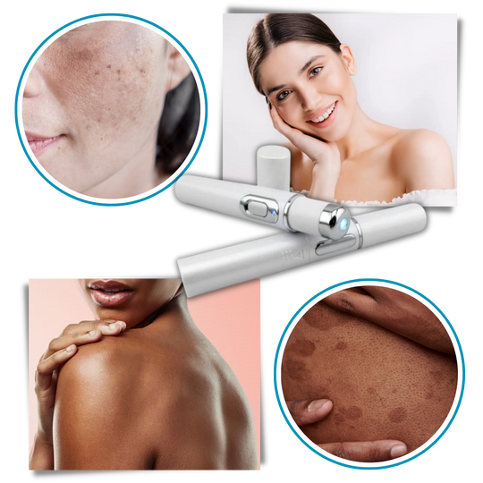 Draagbare Lasertherapie voor een Stralende Teint 5