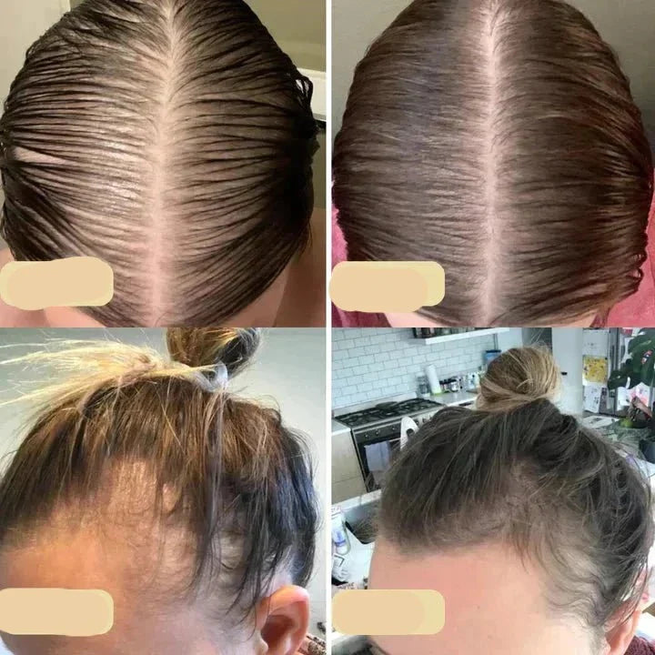 Haarverzorging Olie voor Groei en Versterking 3